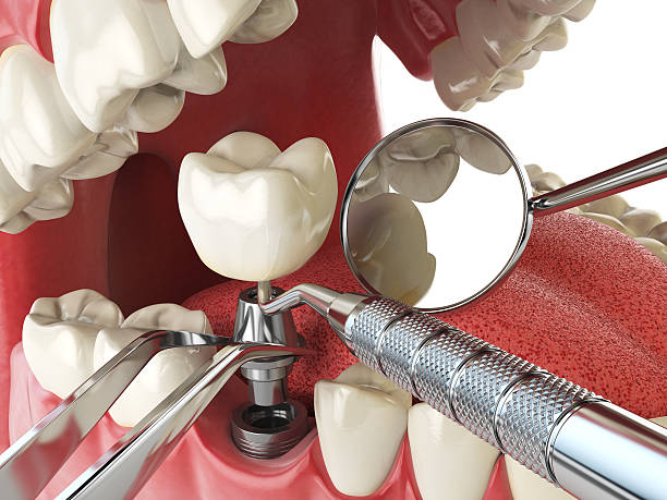 Best Emergency Dental Services for Seniors in Escanaba, MI