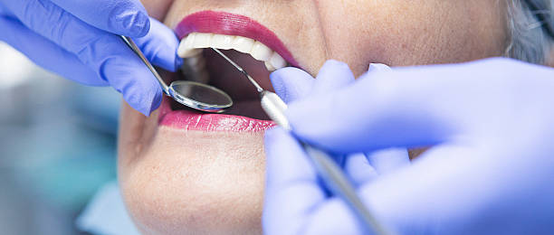 Best Emergency Dentist for Knocked-Out Tooth in Escanaba, MI