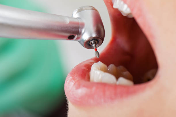 Best Broken or Cracked Tooth Emergency Dentist in Escanaba, MI